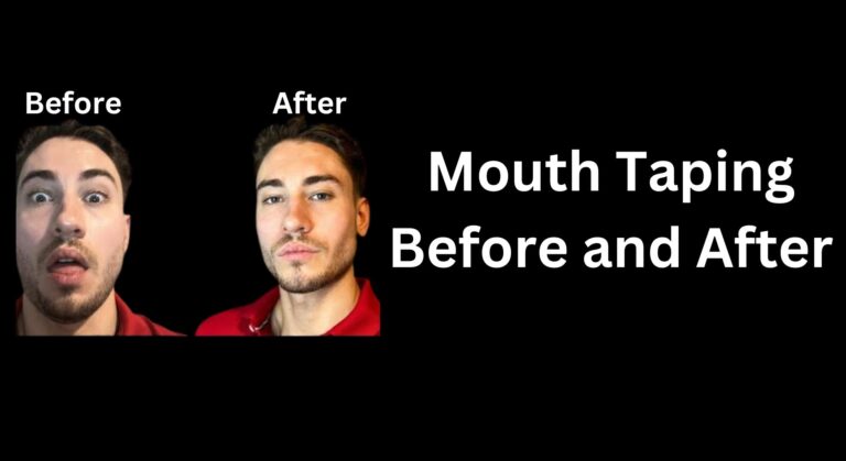 Mouth Taping Before and After