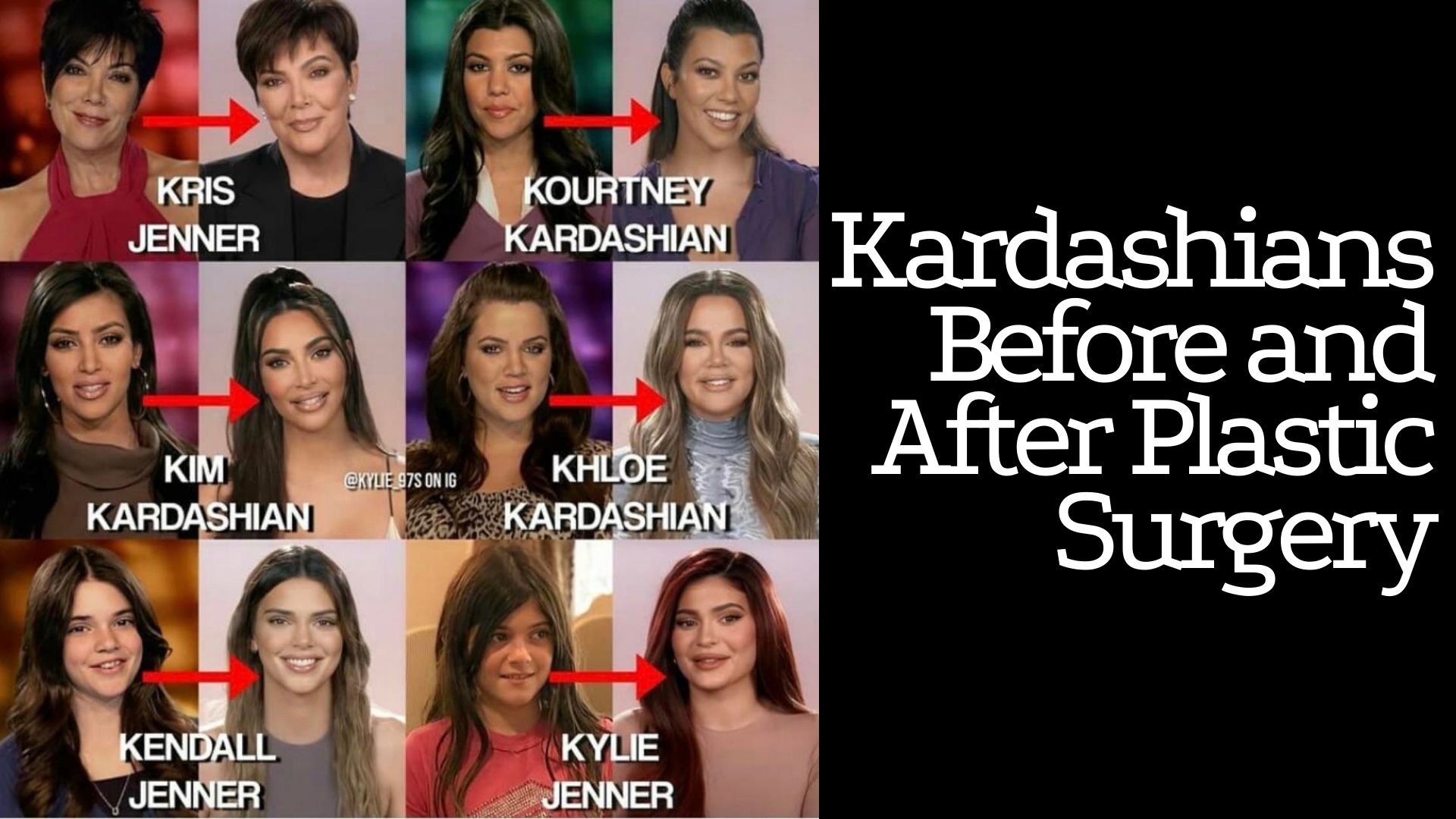 Kardashians Before and After Plastic Surgery