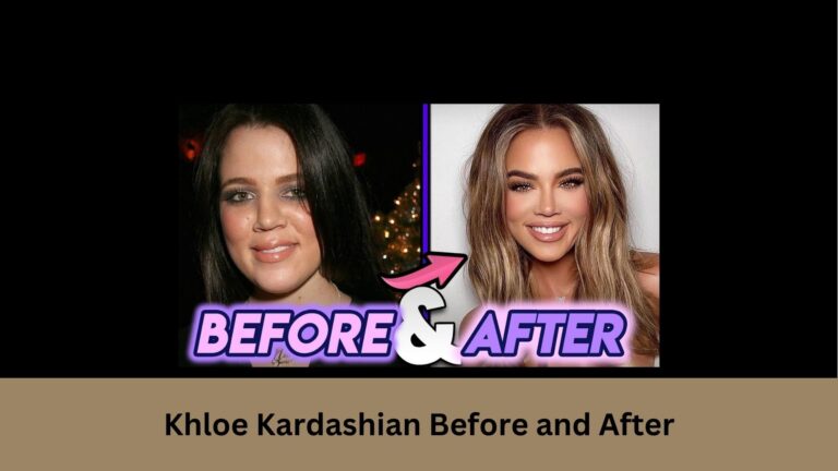 Khloe Kardashian Before and After