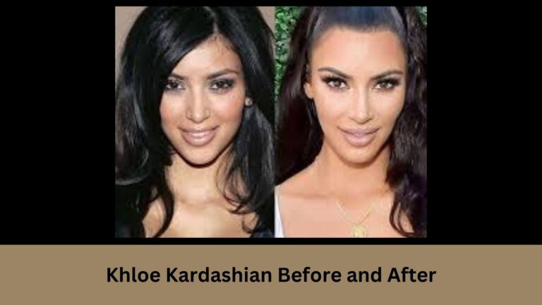 Kim Kardashian Before and After