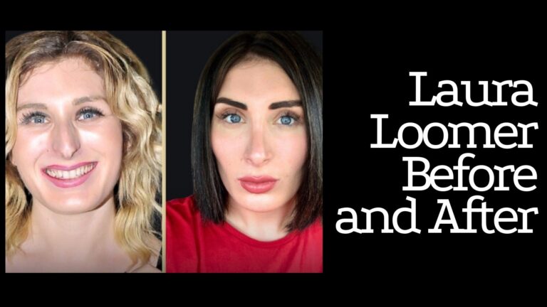 Laura Loomer Before and After