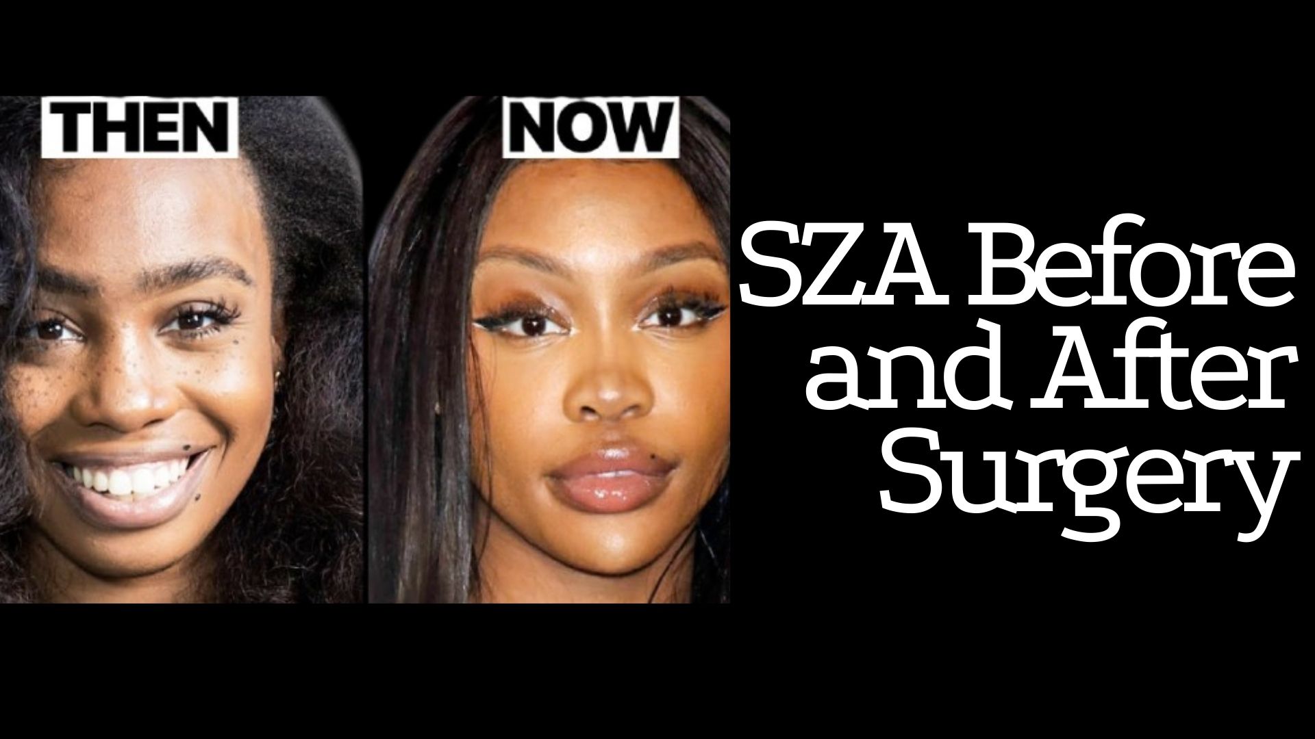 SZA Before and After Surgery